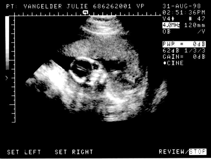 Sonogram